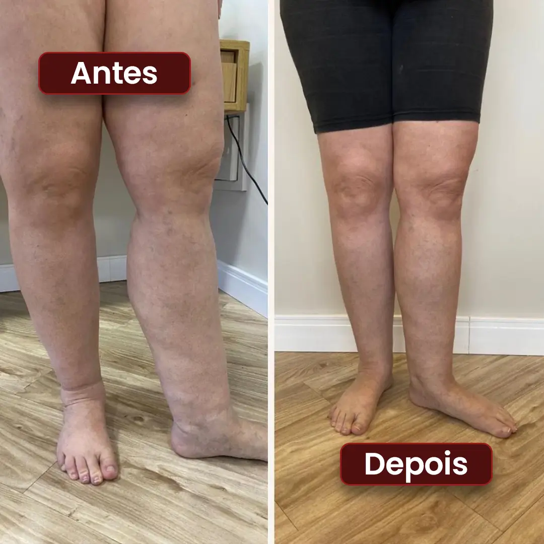 Antes e depois 01