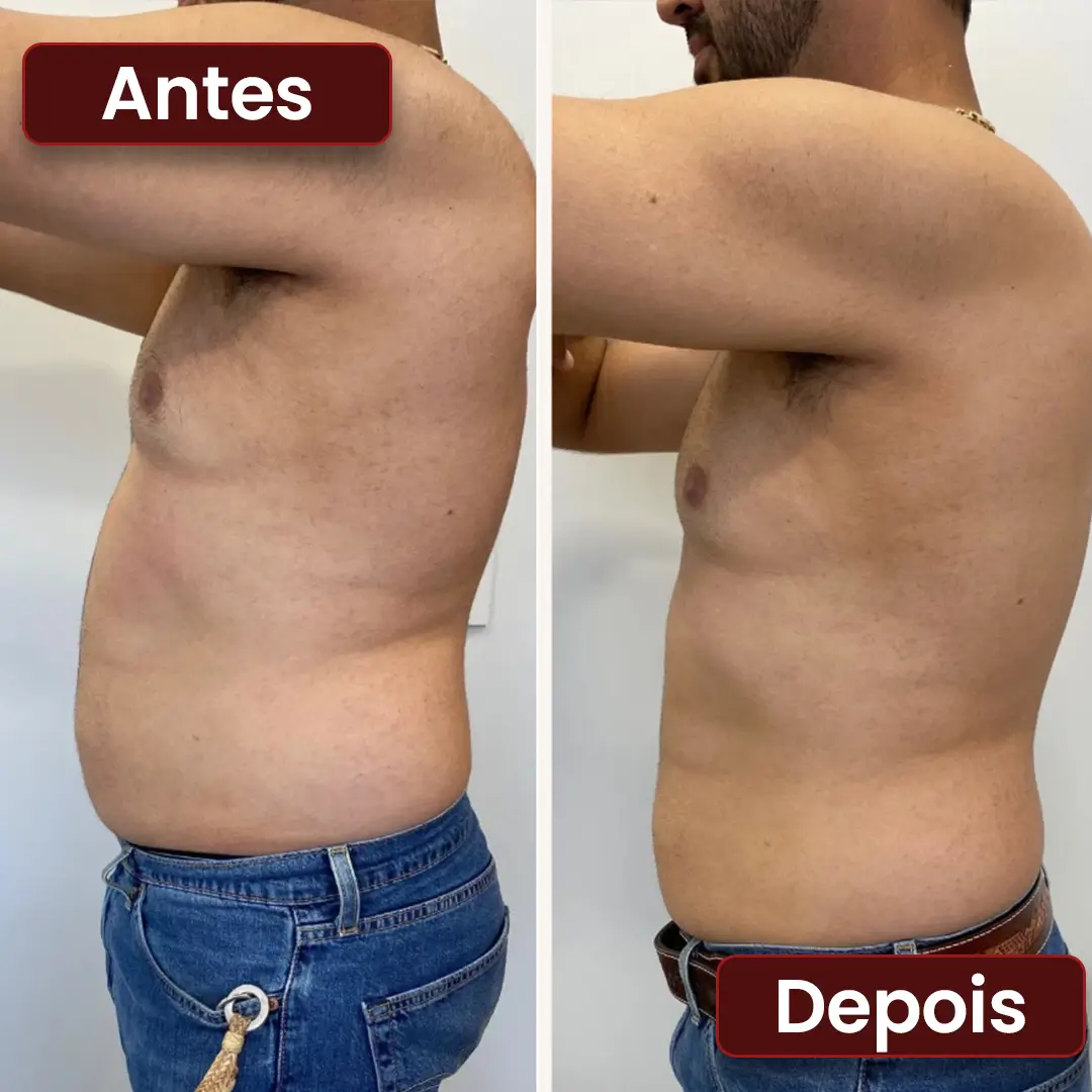 Antes e depois 02