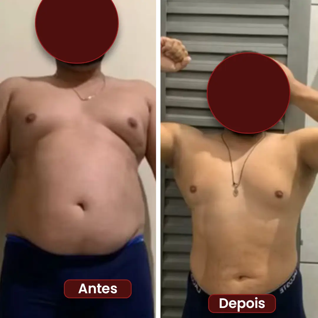 Antes e depois 03
